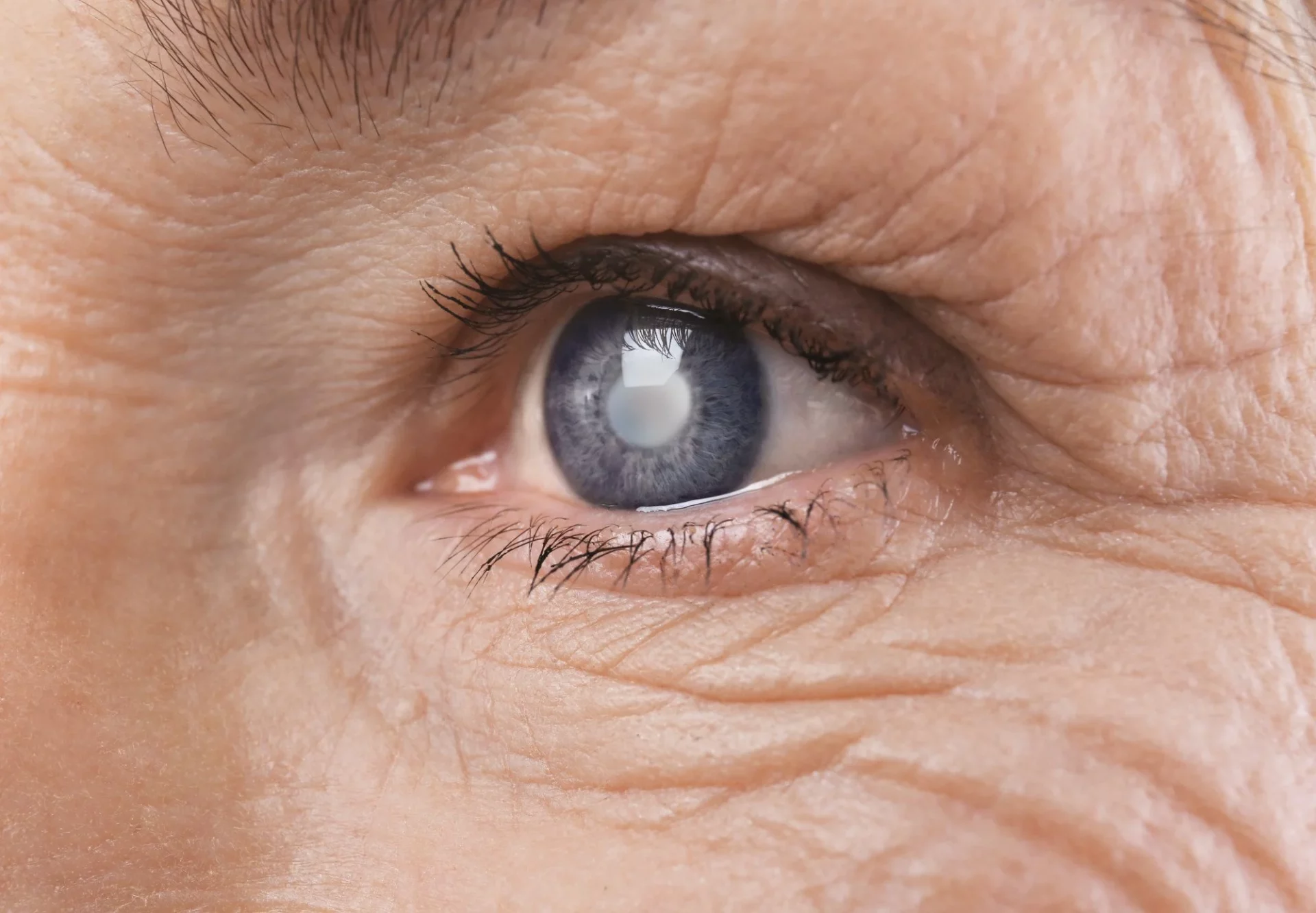 training eyes after cataract surgery