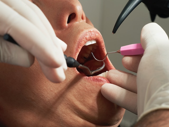 The Importance of Dental Checkups – A Key Element of Healthcare