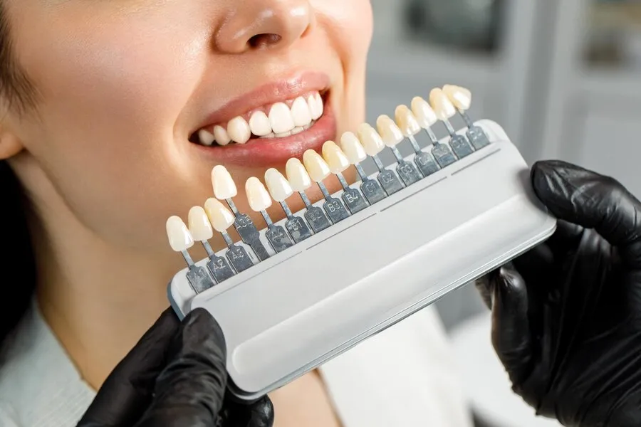 ssues Dental Veneers Can Help to Conceal