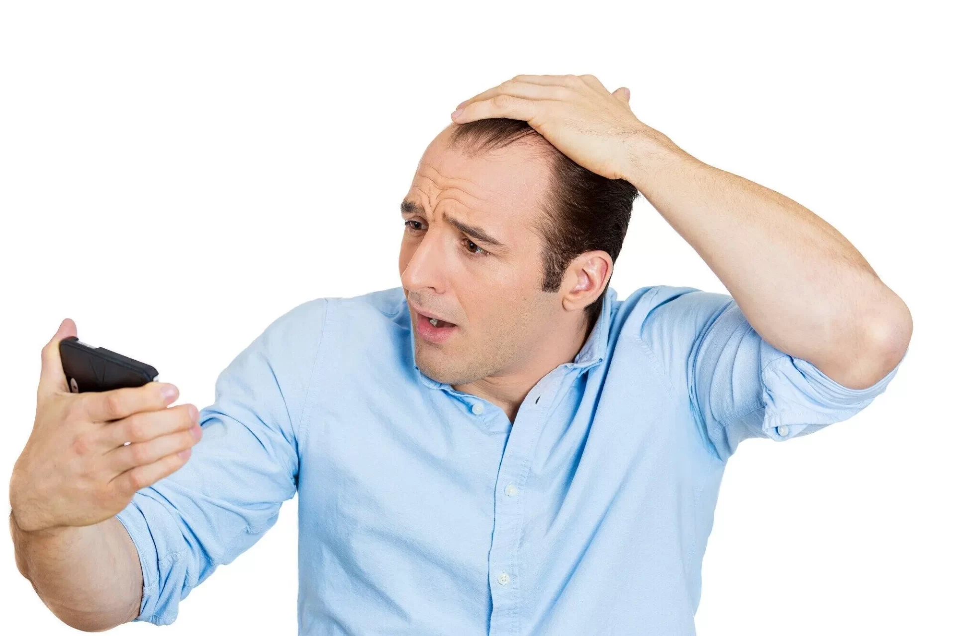 6 Common Signs of a Receding Hairline You Need to Know