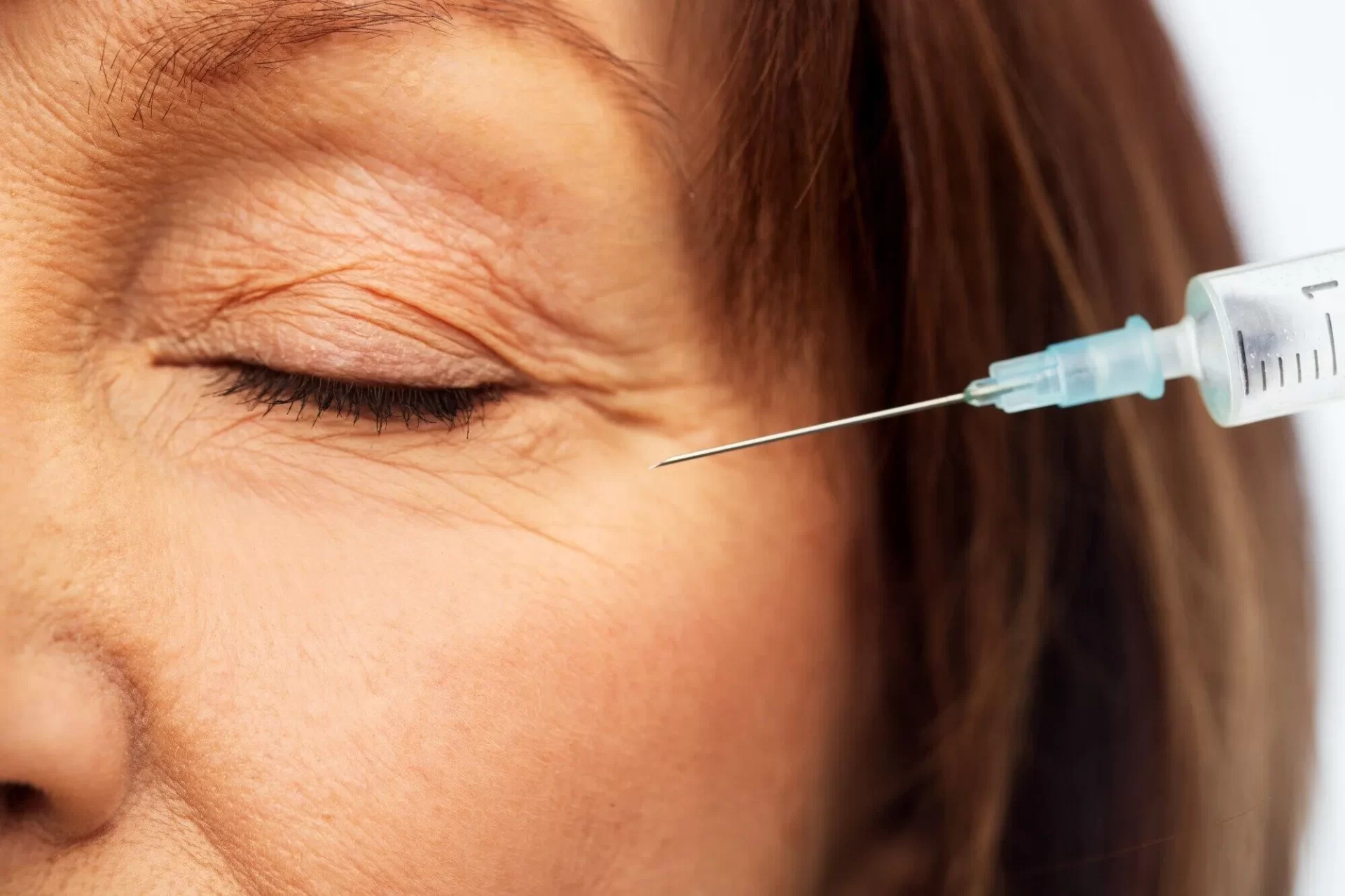 What Factors Can Impact to Lower Eyelid Surgery Recovery Time?